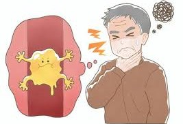 Understanding Throat Infections and Their Treatment Understanding Throat Infections and Their Treatment